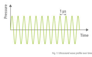 1 Ultrasound Wave Profile Over Time