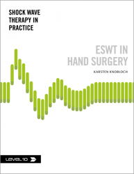 Storz – ESWT in hand surgery